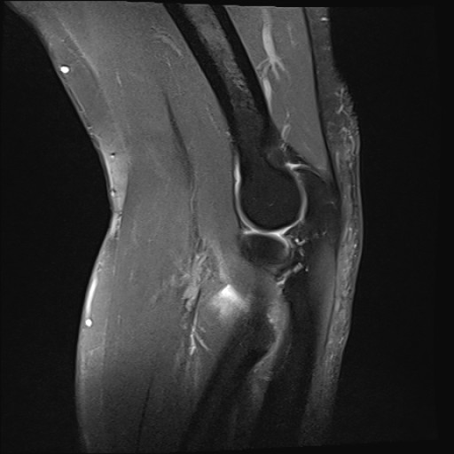 Click on the Serie image to view the images of Wieszt, Gnter